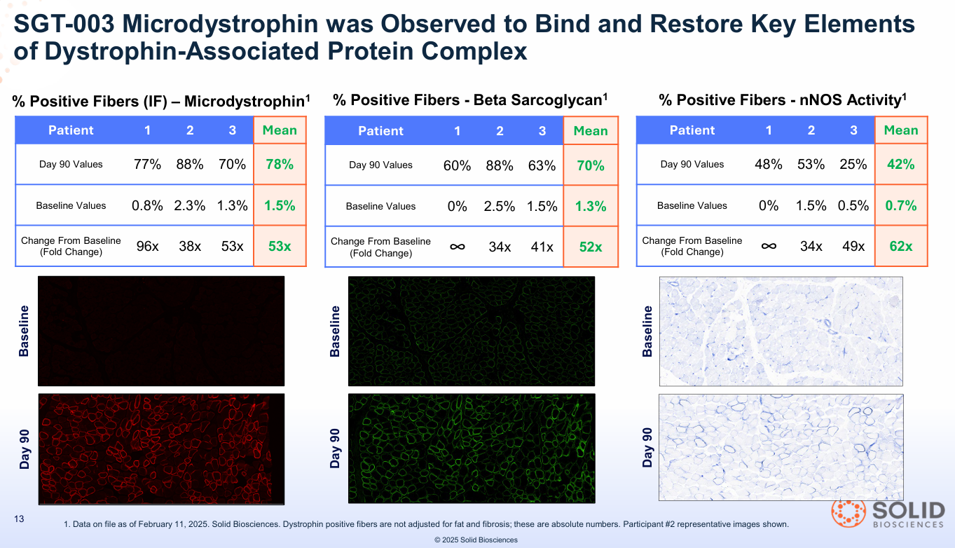 The $12B Alarm Bell: Smart Money is Buying Solid Biosciences ($SLDB) While Retail Investors are Sleeping